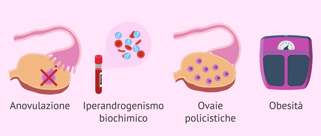 sintomi-pcos-cause