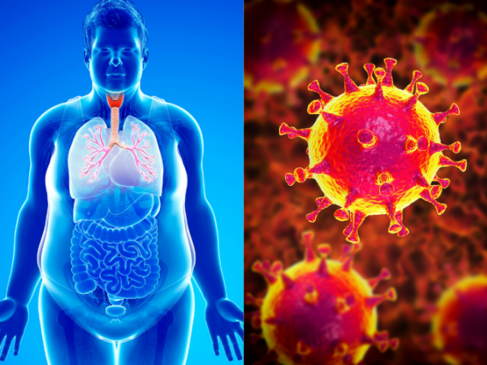 Covid-19-and-Obesity