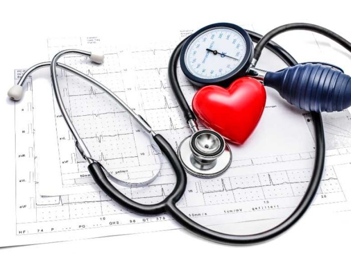elettrocardiogramma-ECG