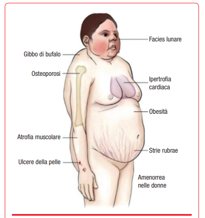 sindrome-cushing-terapia