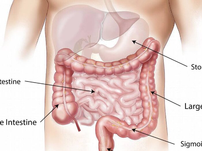 microbiota-bariatrica