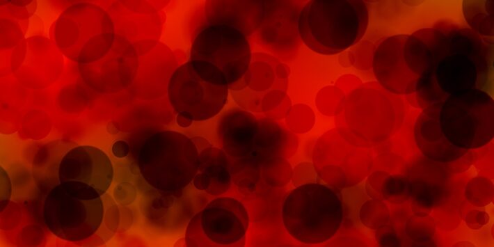 plasma