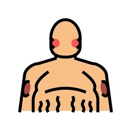 sindrome-Cushing