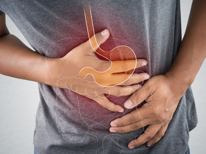 sindrome-intestino-irritabile