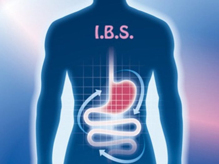 sindrome_colon_irritabile