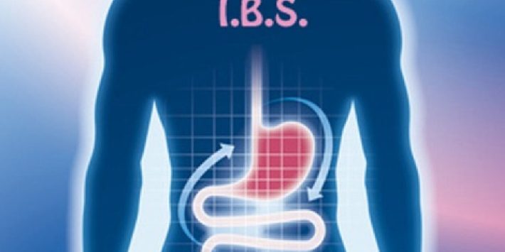 sindrome_colon_irritabile