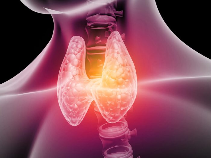 tiroide-gozzo